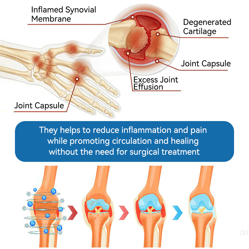 𝖯𝗂g𝐮𝐢𝐚𝐲® BPC-157 Joint Healing Cream🦴Treats Arthritis, Neuropathy, Rheumatism, Sports Injuries & More👍
