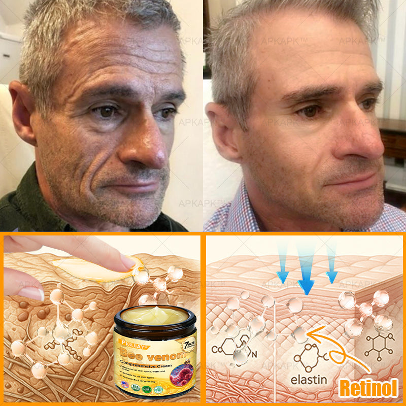 🔥 FLASH SALE! Extra 50% OFF 🔥 | Limited-Time Discount! TLOPA® Bee Venom Skin Restoration Cream🌞