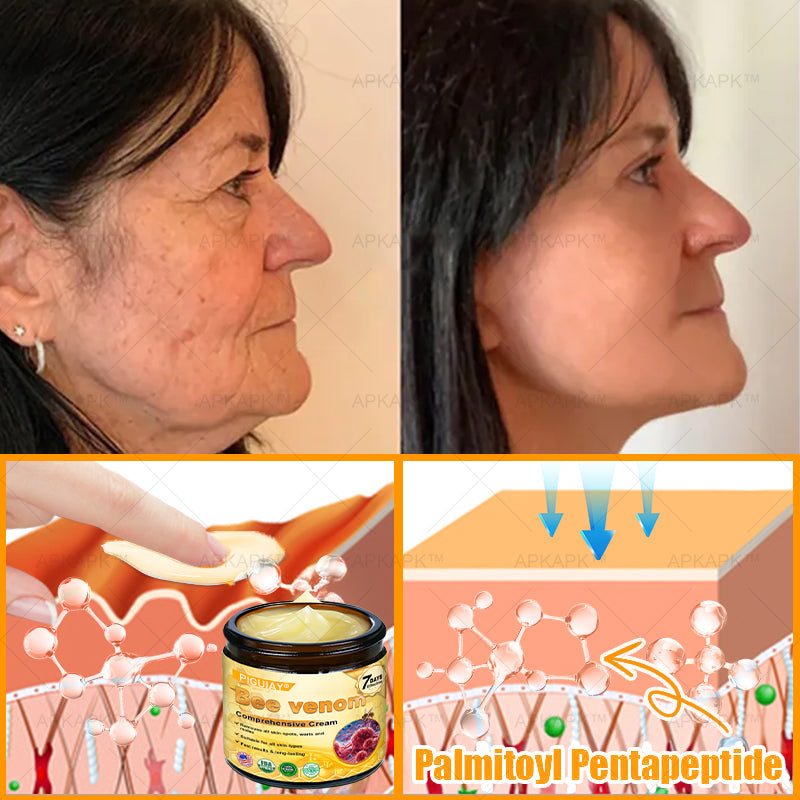 🔥 FLASH SALE! Extra 50% OFF 🔥 | Limited-Time Discount! TLOPA® Bee Venom Skin Restoration Cream🌞