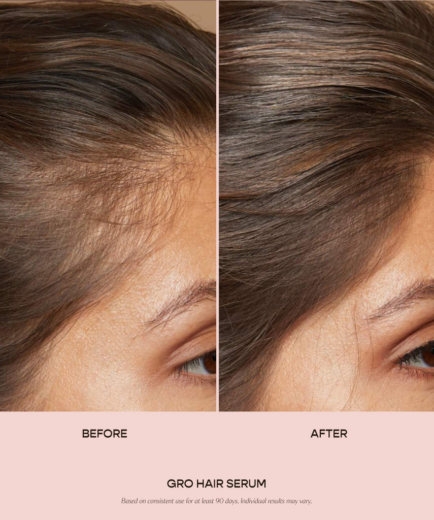 💎CvReOz® Vegamour Hair Serum(🌿Pure plant extracts丨🚫Non-toxic✅Promote hair growth✅Reduce hair loss✅Enhance hair density)
