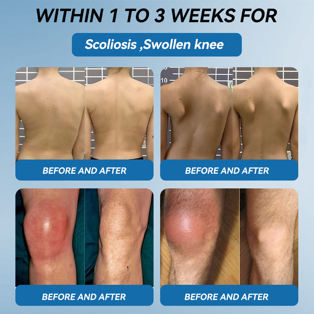 𝖯𝗂g𝐮𝐢𝐚𝐲® BPC-157 Joint Healing Cream🦴Treats Arthritis, Neuropathy, Rheumatism, Sports Injuries & More👍