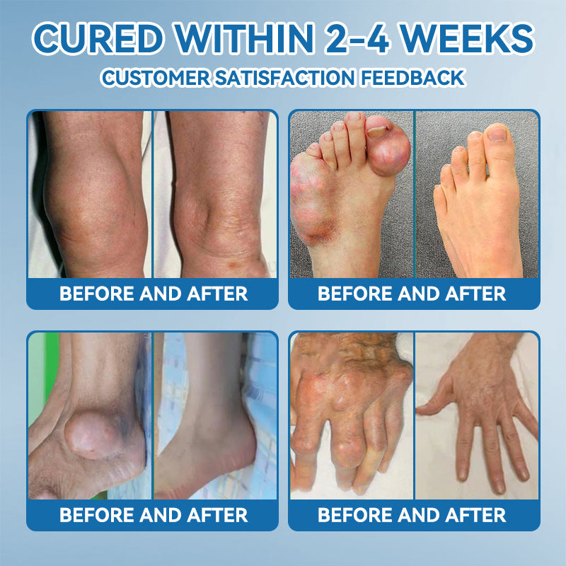 𝖯𝗂g𝐮𝐢𝐚𝐲® BPC-157 Joint Healing Cream🦴Treats Arthritis, Neuropathy, Rheumatism, Sports Injuries & More👍