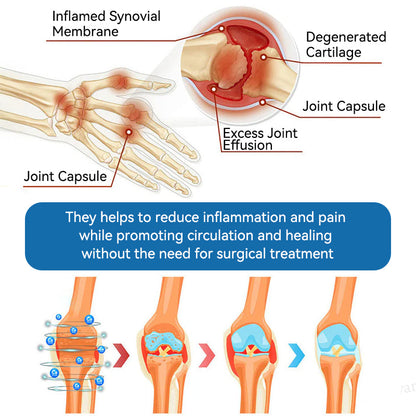 𝖯𝗂g𝐮𝐢𝐚𝐲® BPC-157 Joint Healing Cream🦴Treats Arthritis, Neuropathy, Rheumatism, Sports Injuries & More👍