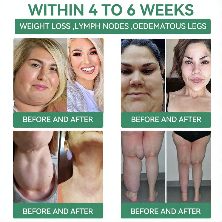 【Last Day Promotion 80% OFF🔥】Cvreoz®NIDDK-Tirzepatide Slimming & health NANO MICRONEEDLE PATCH🇺🇸👨‍⚕️（Zero Pain, 24/7 Release | Lose 20lbs FAST | 90% Sugar Drop | 😊）