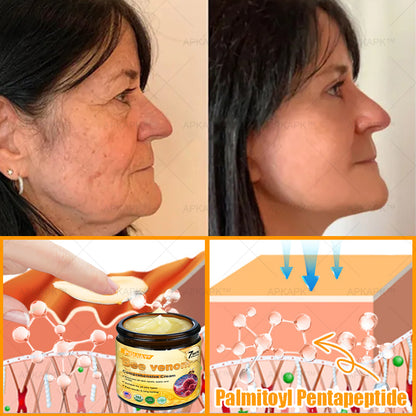 🔥 FLASH SALE! Extra 50% OFF 🔥 | Limited-Time Discount! TLOPA® Bee Venom Skin Restoration Cream🌞