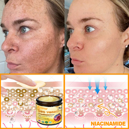 🔥 FLASH SALE! Extra 50% OFF 🔥 | Limited-Time Discount! TLOPA® Bee Venom Skin Restoration Cream🌞