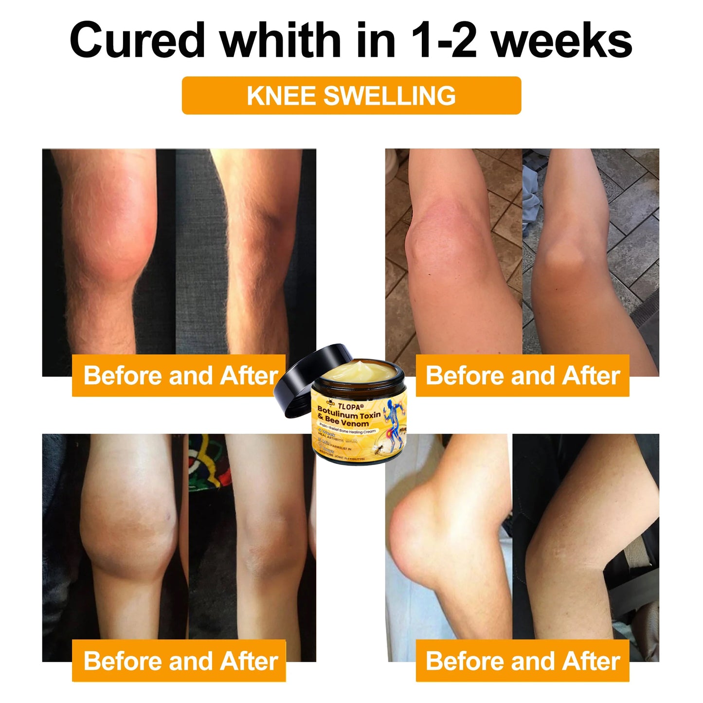 Official Store💎TLOPA® Botulinum Toxin & Bee Venom Pain-Relief Bone Healing Cream💎㊇
