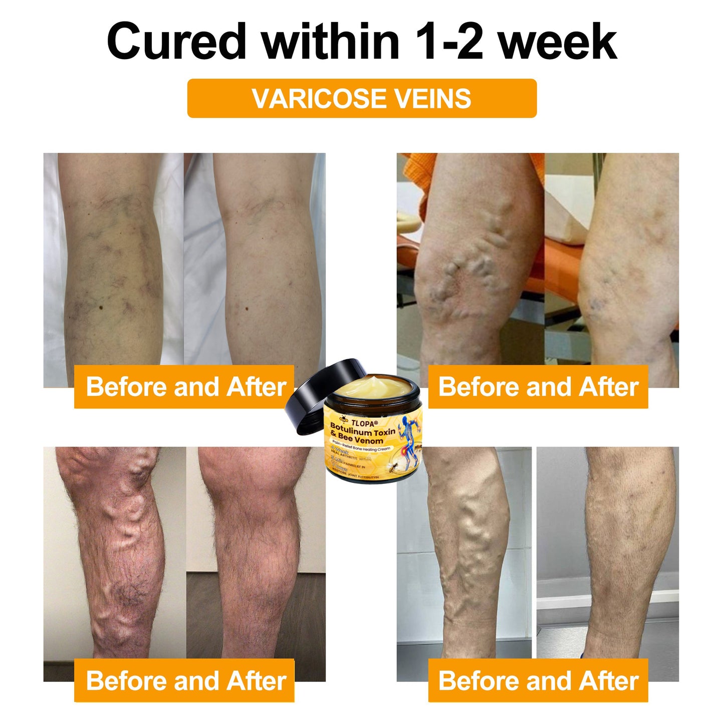 Official Store💎TLOPA® Botulinum Toxin & Bee Venom Pain-Relief Bone Healing Cream💎㊇
