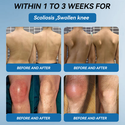 𝖯𝗂g𝐮𝐢𝐚𝐲® BPC-157 Joint Healing Cream🦴Treats Arthritis, Neuropathy, Rheumatism, Sports Injuries & More👍