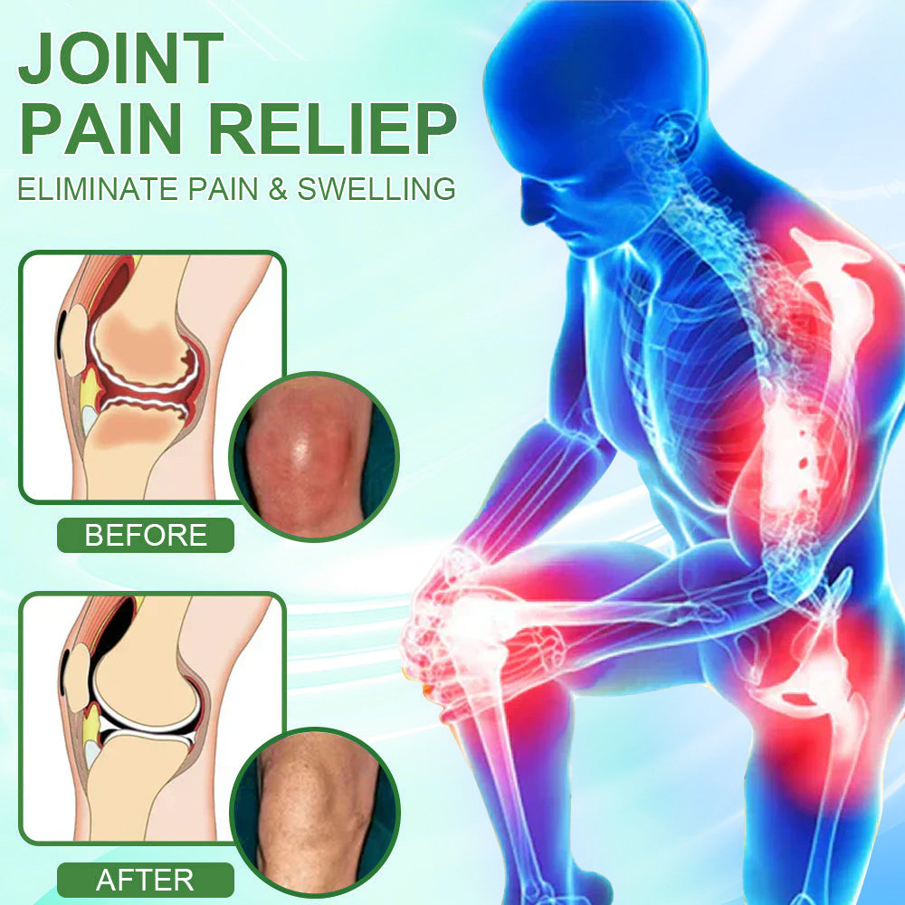 🎁𝐎𝐟𝐟𝐢𝐜𝐢𝐚𝐥 𝐒𝐭𝐨𝐫𝐞: TLOPA® Chillflex Mint Pain Relief Cream  (Treatment for arthritis, neuropathyy, rheumatic diseases, muscle spasms, twitches and sports injuries)