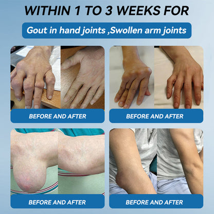 𝖯𝗂g𝐮𝐢𝐚𝐲® BPC-157 Joint Healing Cream🦴Treats Arthritis, Neuropathy, Rheumatism, Sports Injuries & More👍
