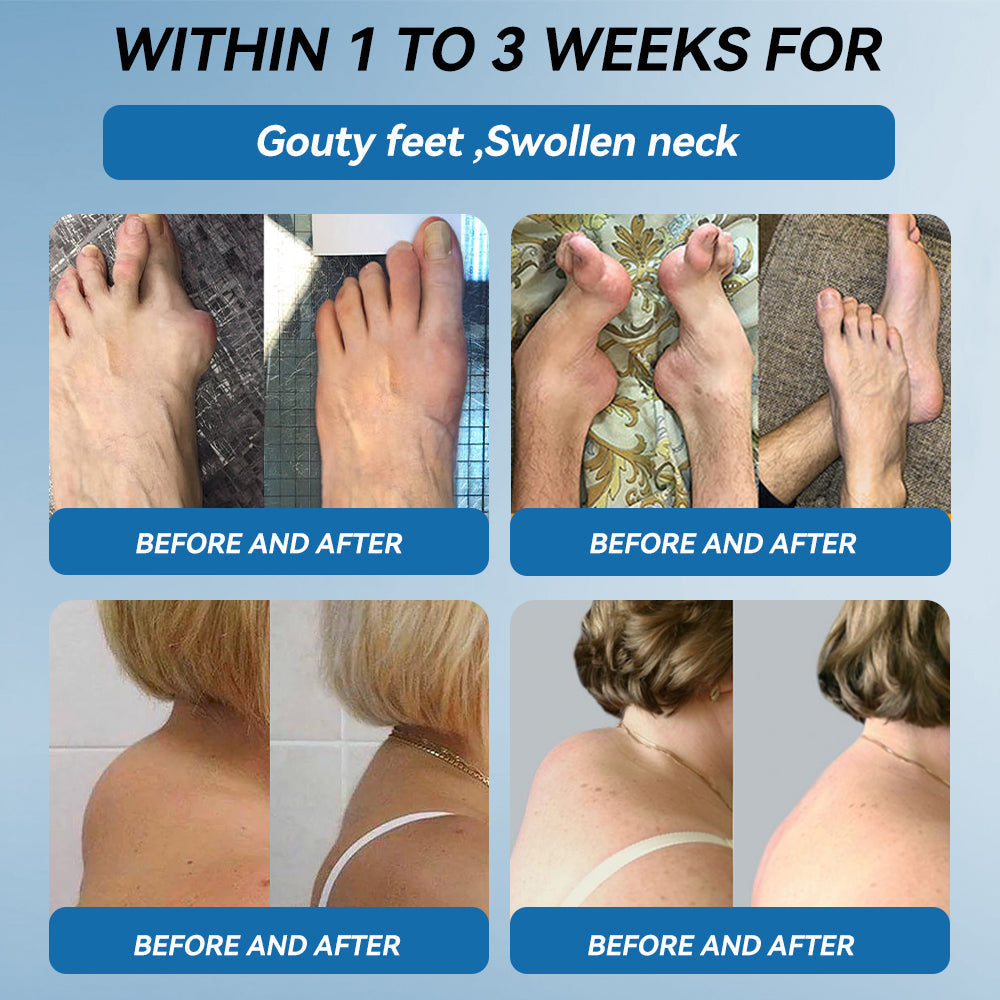 𝖯𝗂g𝐮𝐢𝐚𝐲® BPC-157 Joint Healing Cream🦴Treats Arthritis, Neuropathy, Rheumatism, Sports Injuries & More👍