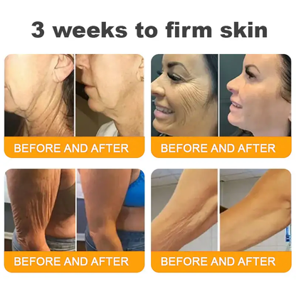 🔥 FLASH SALE! Extra 50% OFF 🔥 | Limited-Time Discount! TLOPA® Bee Venom Skin Restoration Cream🌞