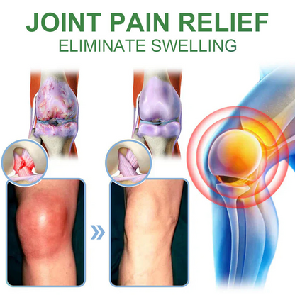 🎁𝐎𝐟𝐟𝐢𝐜𝐢𝐚𝐥 𝐒𝐭𝐨𝐫𝐞: TLOPA® Chillflex Mint Pain Relief Cream  (Treatment for arthritis, neuropathyy, rheumatic diseases, muscle spasms, twitches and sports injuries)